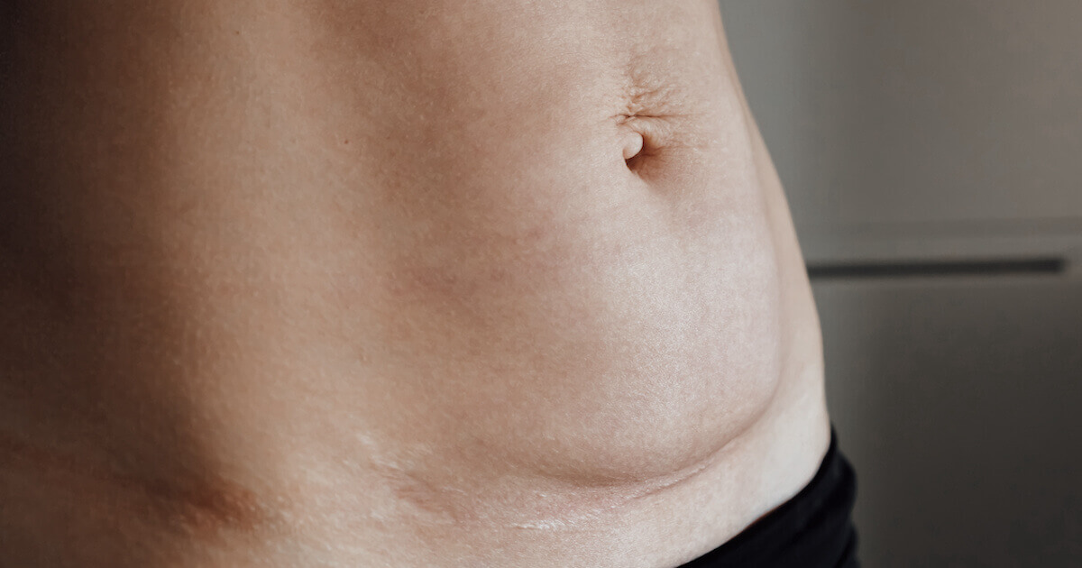 Postpartum Recovery