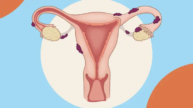 Reproductive & General Gynecology